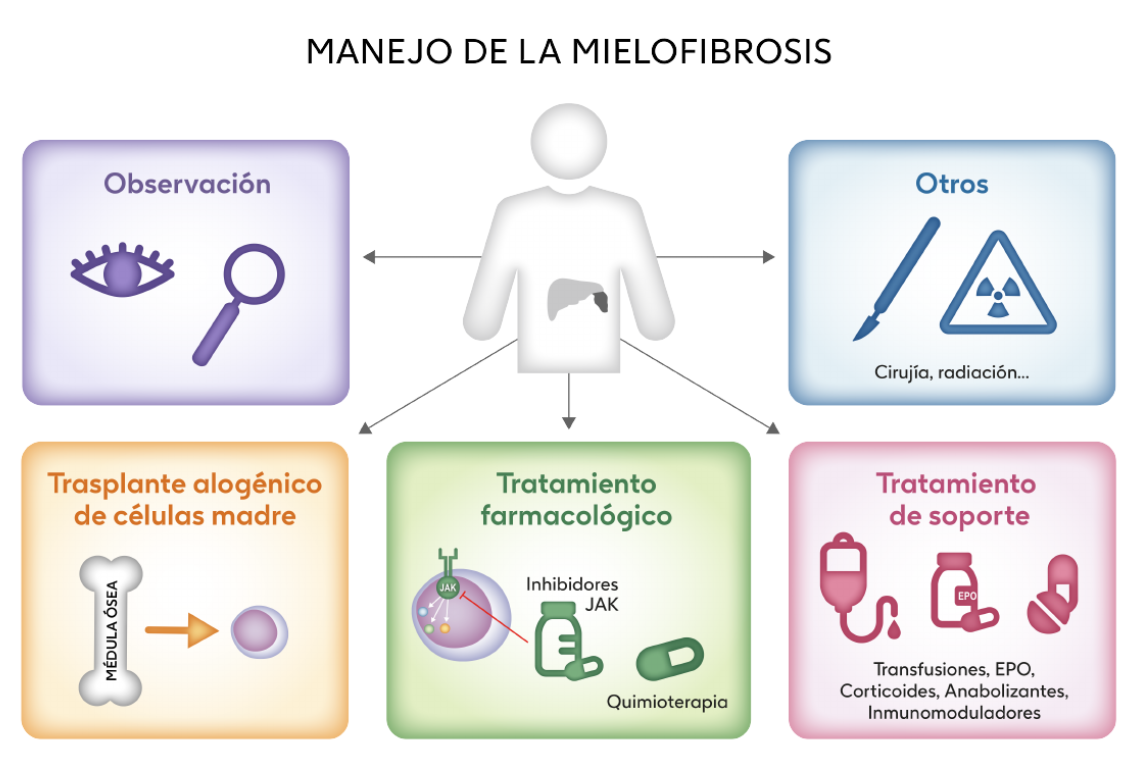Infografía sobre el tratamiento de la mielofibrosis: farmacos anti jak, inhibidores de jak