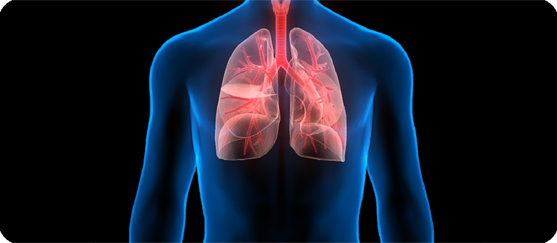 Hipertensión Arterial Pulmonar