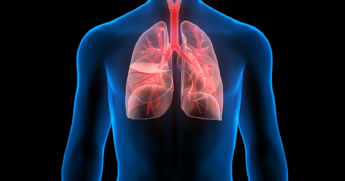 Hipertensión Arterial Pulmonar