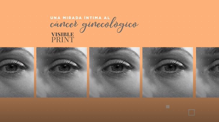 Visible Print: Una mirada íntima al cáncer ginecológico